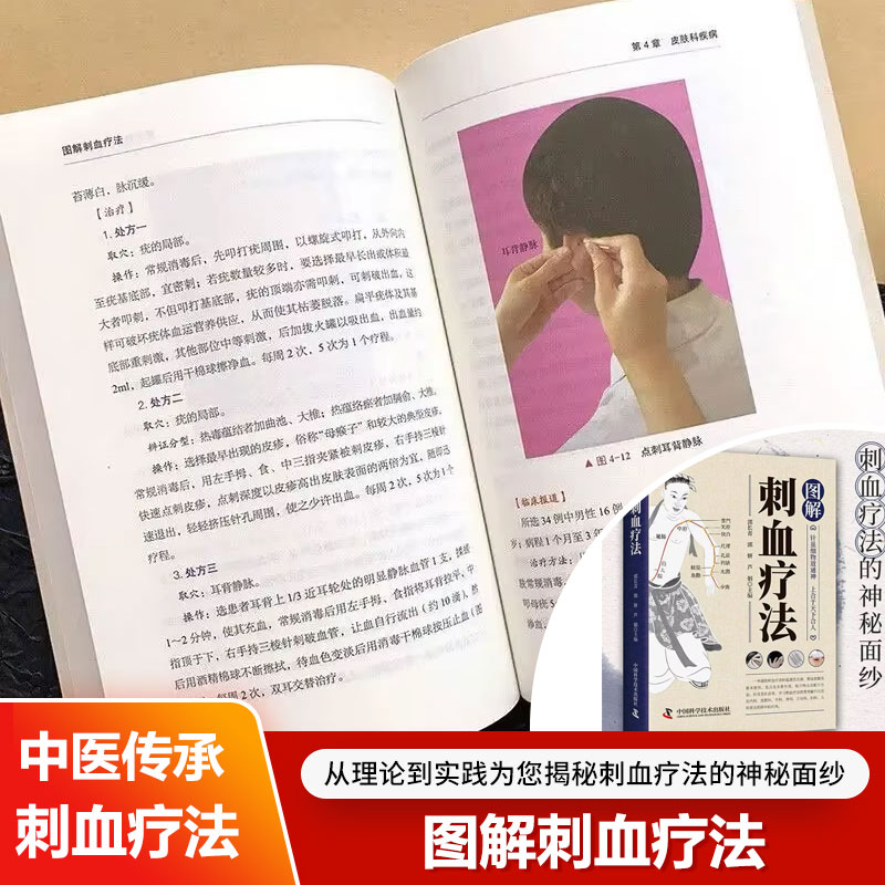 คำอธิบายเกี่ยวกับการบำบัดด้วยก - Therapy Health And Wellness บทวิจารณ์และราคา